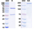 SDS-PAGE for Anti-Human NTRK3/TrkC Antibody (SAA1967)