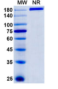Anti-Human VAP-1/AOC3 Reference Antibody (Timolumab) – Figure 1 of 1