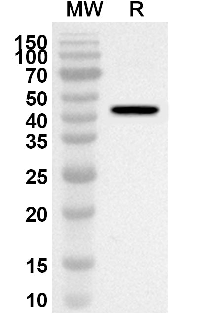 Western blot analysis was performed using anti-CRY1 polyclonal antibody at 1ug/mL on recombinant CRY1 (Catalog No. HS723012).