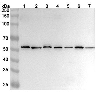 Western blot analysis was performed using anti-CD226 polyclonal antibody at 1ug/mL on various samples.
Lane 1: Jurkat cell lysate
Lane 2: PC-12 cell lysate
Lane 3: Hela cell lysate
Lane 4: Mouse spleen lysate
Lane 5: Mouse lung lysate
Lane 6: Rat spleen lysate
Lane 7: Rat lung lysate