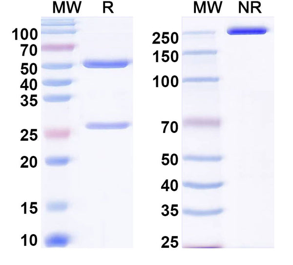 SDS-PAGE for Anti-Human POSTN/OSF-2 Antibody (LG3)