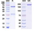 SDS-PAGE for Anti-Human POSTN/OSF-2 Monoclonal Antibody (1A072)