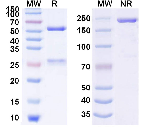 SDS-PAGE for Anti-Human POSTN/OSF-2 Monoclonal Antibody (1A072)