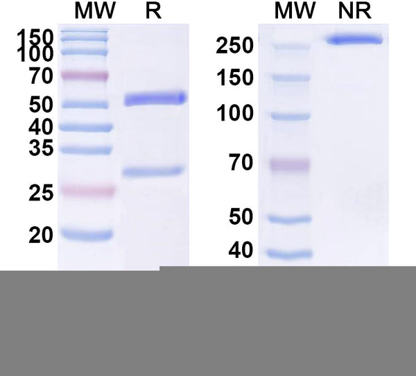 SDS-PAGE for Anti-Human POSTN/OSF-2 Monoclonal Antibody (1A073)