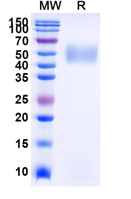 Recombinant Human CD111/NECTIN1 Protein, C-His