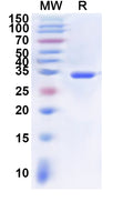 Recombinant Human RBBP5 Protein, N-His