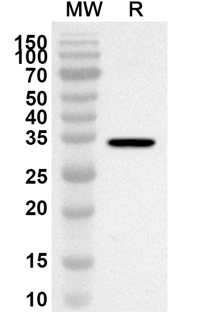 Western blot analysis was performed using anti-RBBP5 polyclonal antibody at 1ug/mL on recombinant RBBP5 (Catalog No. HS761012).