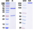 SDS-PAGE for Anti-Human SETMAR IP Antibody (SAA0224)
