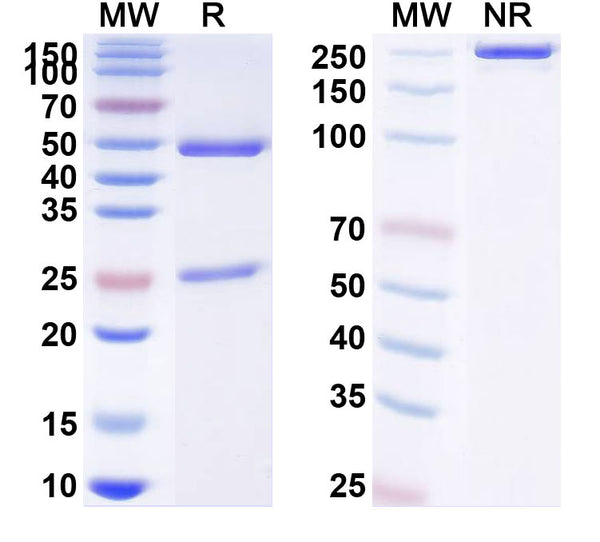 SDS-PAGE for Anti-Human SETMAR IP Antibody (SAA0224)