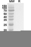 Western blot analysis was performed using anti-KISS1 polyclonal antibody at 1ug/mL on recombinant KISS1 (Catalog No. HS770012).