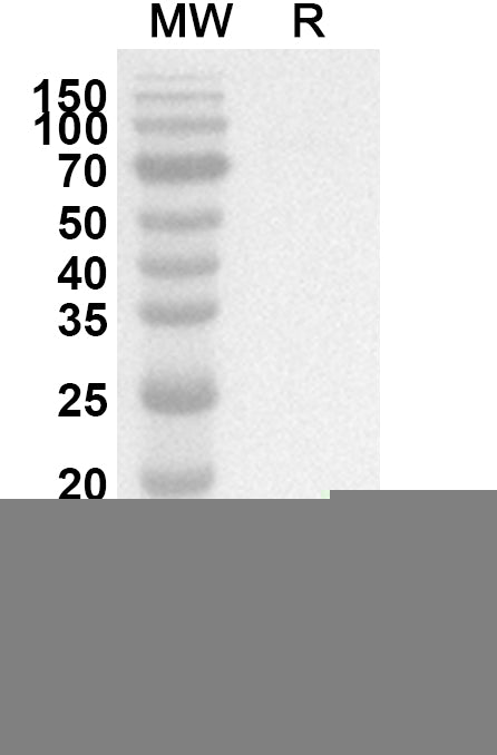 Western blot analysis was performed using anti-KISS1 polyclonal antibody at 1ug/mL on recombinant KISS1 (Catalog No. HS770012).