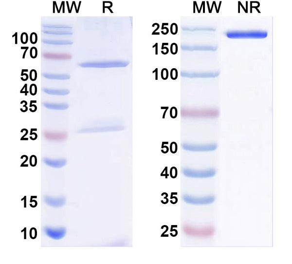 SDS-PAGE for Anti-Frataxin Antibody (N191/6)