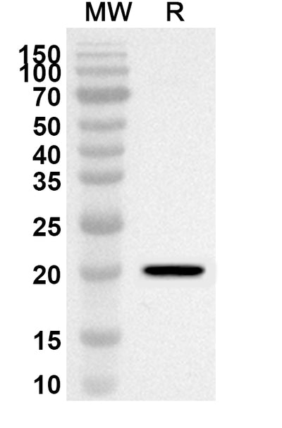 Western blot analysis was performed using anti-Human PTGES3/P23 polyclonal antibody at 1ug/mL on recombinant Human PTGES3/P23 (Catalog No. HS799012).