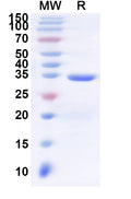 Recombinant Human C3AR1 Protein, N-His-KSI
