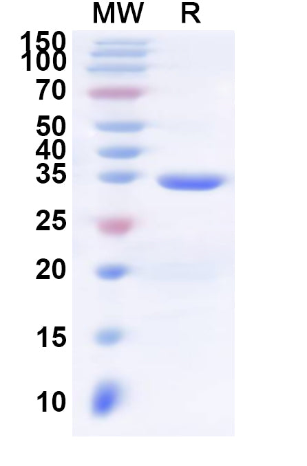 Recombinant Human C3AR1 Protein, N-His-KSI