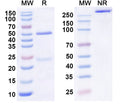 SDS-PAGE for Anti-Human C3AR1 Antibody (SAA0776)
