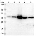 Western blot analysis was performed using anti-KYAT1 polyclonal antibody at 1μg/ml on various samples.
Lane 1: Raji cell lysate
Lane 2: SW620 cell lysate
Lane 3: Mouse liver lysate
Lane 4: Mouse kidney lysate
Lane 5: Mouse heart lysate