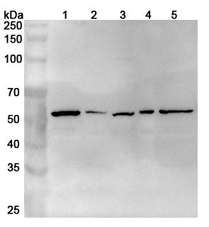 Western blot analysis was performed using anti-PDK1 polyclonal antibody at 1ug/mL on various samples.
Lane 1: NIH3T3 cell lysate
Lane 2: 293T cell lysate
Lane 3: PC-12 cell lysate
Lane 4: Lncap cell lystae
Lane 5: Hela cell lysate