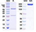 SDS-PAGE for Anti-ANO6/TMEM16F Antibody (N429/14)