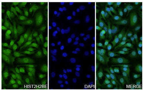 Hela cells were fixed with 4% paraformaldehyde for 20 minutes, followed by blocking with 5% goat serum for 1 hour. The cells were then incubated with a primary antibody targeting HIST2H2BE (HS839014) at a concentration of 13.2 ug/ml overnight at 4°C. Afterward, the cells were incubated with a secondary antibody, Goat Anti-Rabbit IgG (Alexa Fluor-488) for 50 minutes at room temperature. The localization of HIST2H2BE was visualized (shown in green), and nuclear DNA was stained with DAPI (shown in blue).