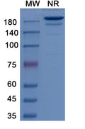 Anti-Human CA9 Reference Antibody (Girentuximab) – Figure 1 of 2