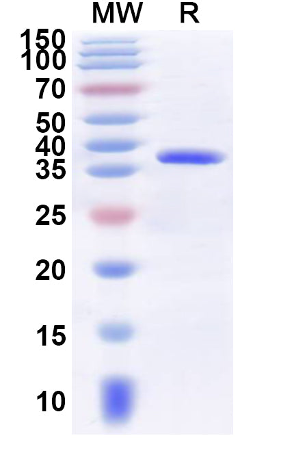 Recombinant Human MLANA Protein, N-GST & C-His