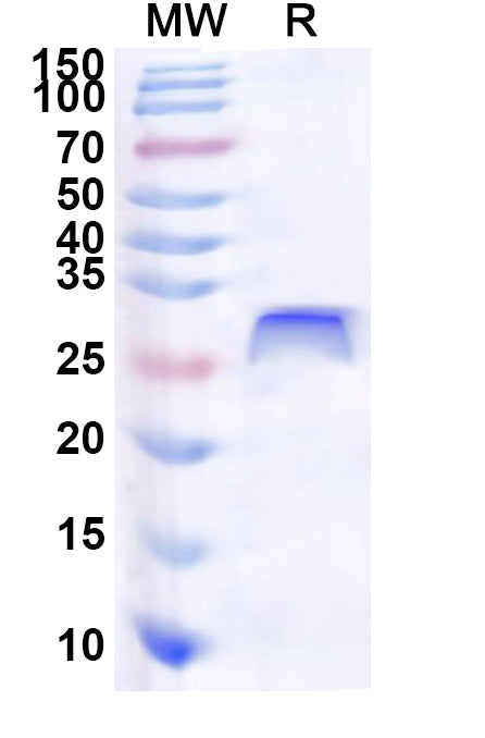 Recombinant Human ZKSCAN8 Protein, N-His