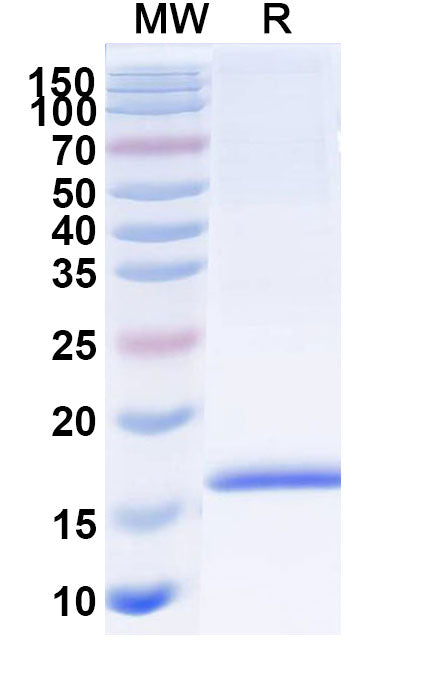 SDS-PAGE for Anti-Human Adiponectin/ACRP30/ADIPOQ Nanobody (SAA1153)