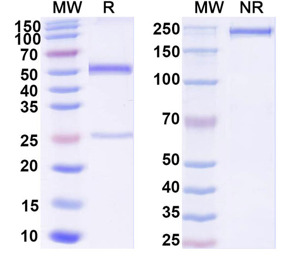 SDS-PAGE for Anti-Human Adiponectin/ADPN Monoclonal Antibody (1A401)