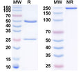 SDS-PAGE for Anti-Human Adiponectin/ADPN Monoclonal Antibody (1A402)