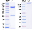 SDS-PAGE for Anti-Human Adiponectin/ADPN Monoclonal Antibody (1A405)