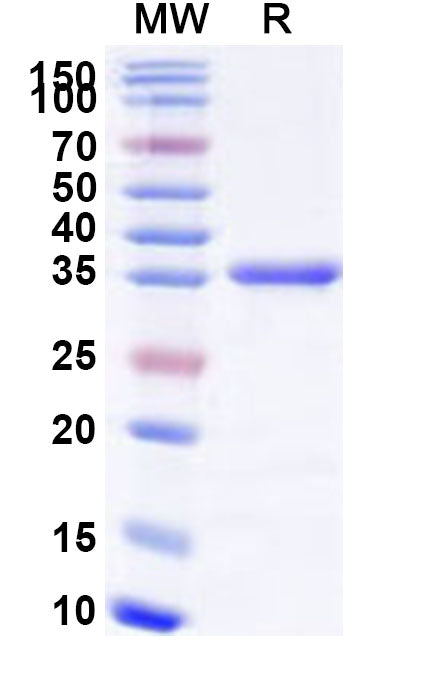 Recombinant Human DDB1 Protein, N-His