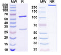 SDS-PAGE for Anti-Human CDK5R1 Antibody (SAA1679)