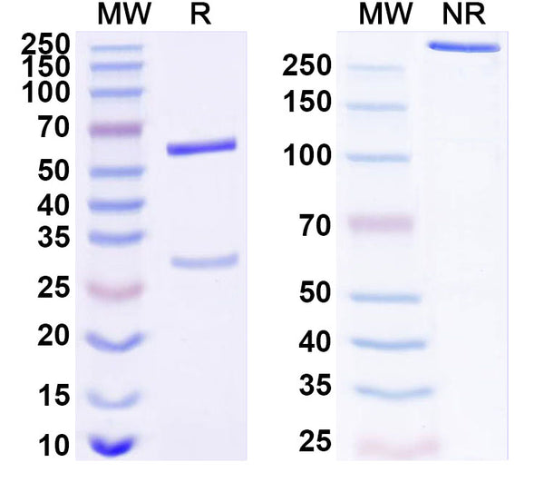 SDS-PAGE for Anti-Human CDK5R1 Antibody (SAA1679)