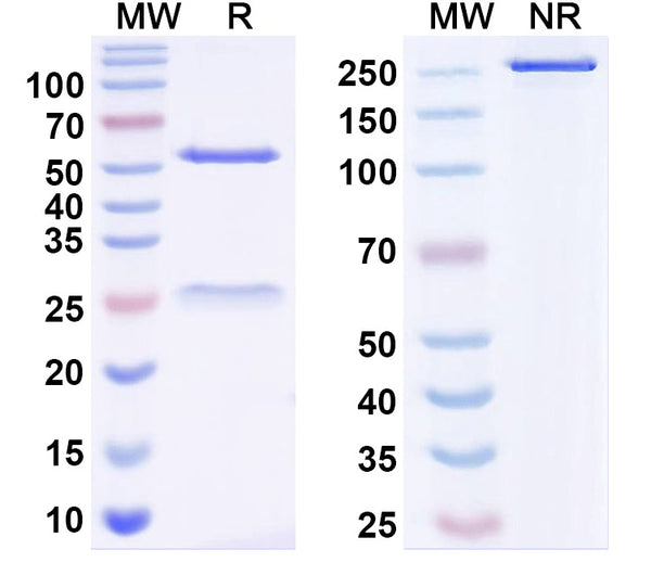 SDS-PAGE for Anti-TrkB Antibody (N457/79)