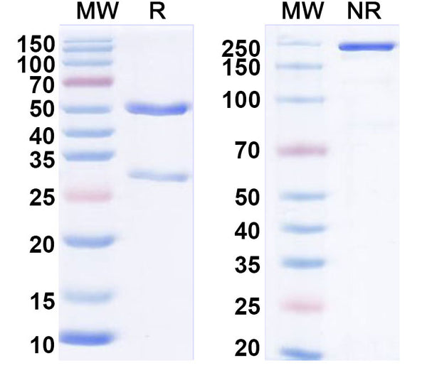 SDS-PAGE for Anti-Human TrkB /NTRK2 Antibody (SAA0477)