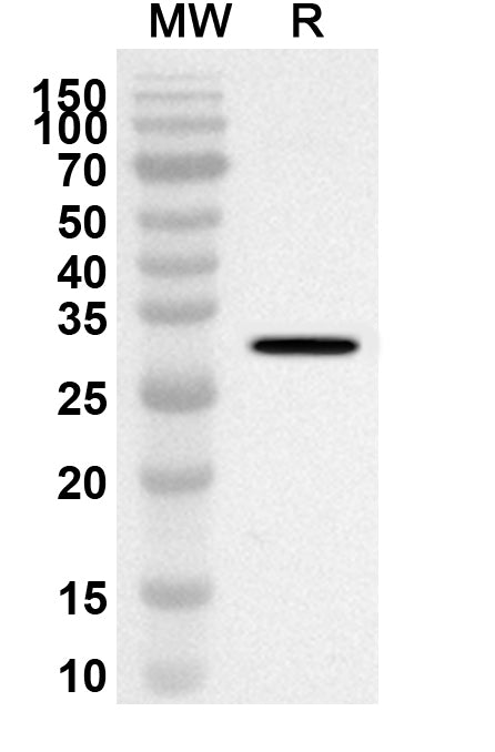 Western blot analysis was performed using anti-PLEC polyclonal antibody at 1ug/mL on recombinant PLEC (Catalog No. HS915012).