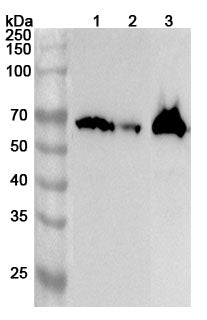 Western blot analysis was performed using anti-ACSM3 polyclonal antibody at 1ug/mL on various samples.
Lane 1: Mouse liver lysate
Lane 2: Mouse kidney lysate
Lane 3: Rat liver lysate