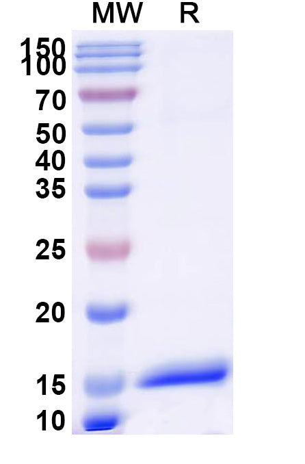 SDS-PAGE for Anti-Human ANGPT1 Nanobody (SAA1256)