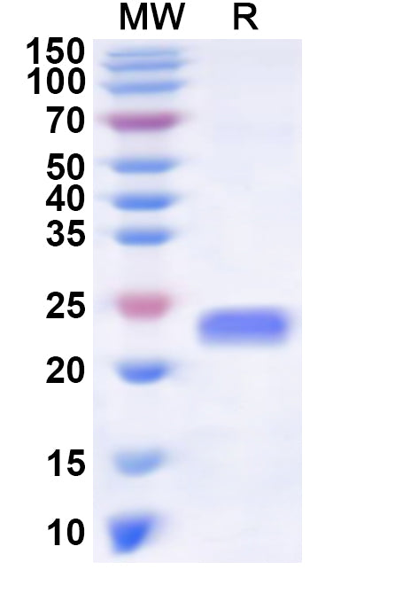 Recombinant Human ZSCAN23 Protein, N-His