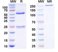 SDS-PAGE for Anti-ASIC2A Antibody (N412A/10)