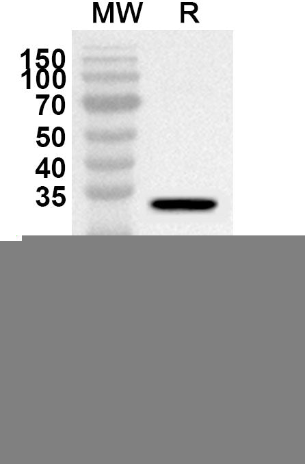Western blot analysis was performed using anti-MAPRE1 polyclonal antibody at 1ug/mL on recombinant MAPRE1 (Catalog No. HS950012).