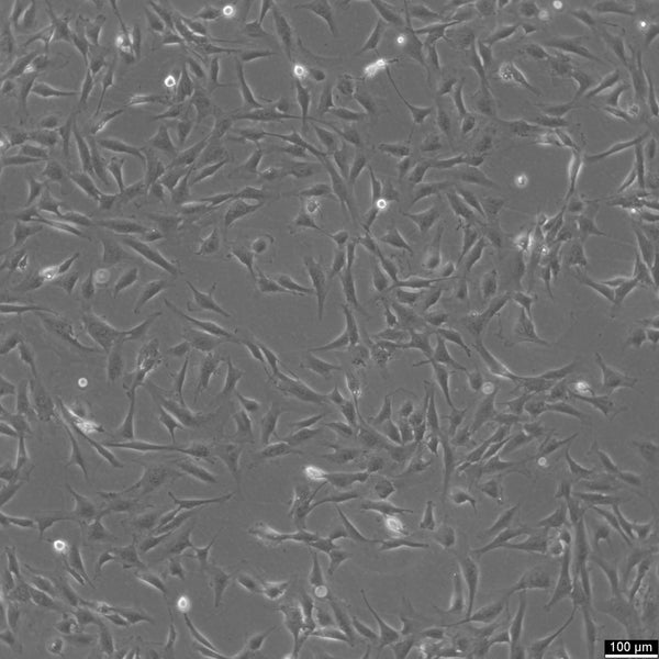 HSF (SV40) cell