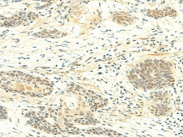 ATMIN Polyclonal Antibody – Figure 1 of 2