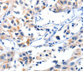 Fibulin 5 Polyclonal Antibody – Figure 1 of 2