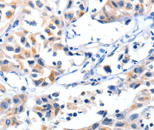 Fibulin 5 Polyclonal Antibody – Figure 1 of 2