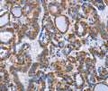 INTS10 Polyclonal Antibody – Figure 1 of 3