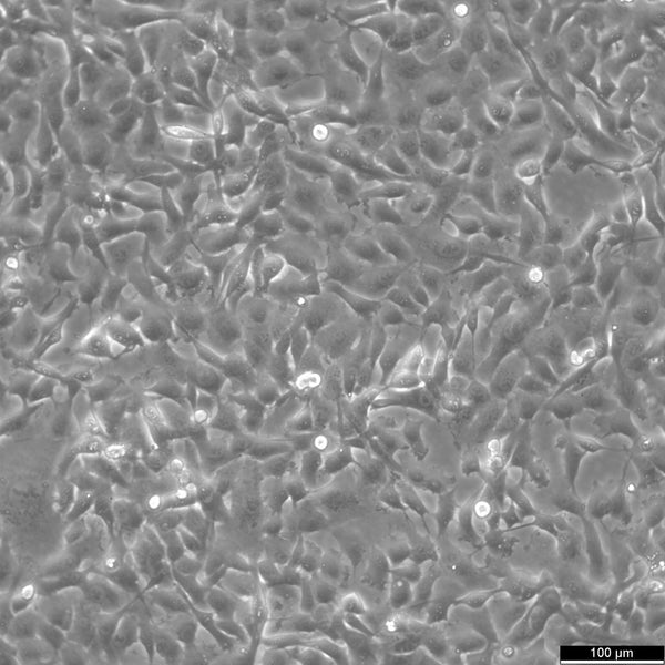 HT-1080 cell
