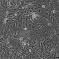 HT-1376 cell