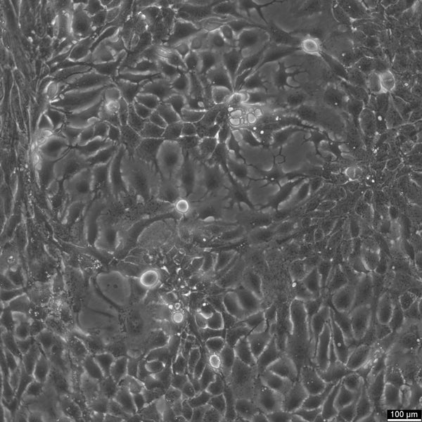 HT-1376 cell